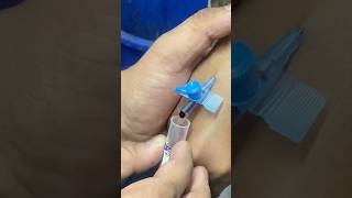 Iv Cannulation  blood collection  song punjabi cannula subscribe ivcannulation bloodtest [upl. by Pool]