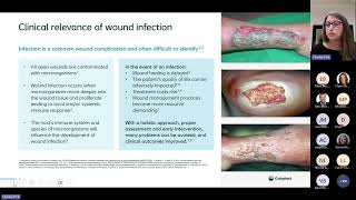 Wound Infection Evening Webinar [upl. by Ytram342]