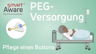 PEGVersorgung Pflege eines Buttons  Fachfortbildungen Pflege  Fortbildungen Pflege [upl. by Urissa]