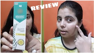 NOMARKS Ayurvedic Antimarks Cream Review  For Oily Skin  Good Product [upl. by Kassi]