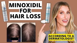 Dermatologist Explains How Minoxidil Works for Hair Loss How to Use Results amp More [upl. by Redyr]