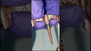 All on 7 screw retained titanium bar fitchecking with dummy MU implants shorts [upl. by Tillio]