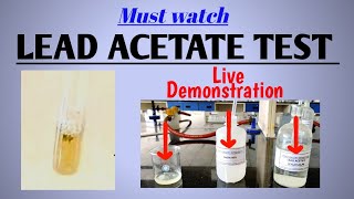 Lead acetate test  Test for sulfur containing amino acids  Biochemistry  NEETPG [upl. by Serilda]