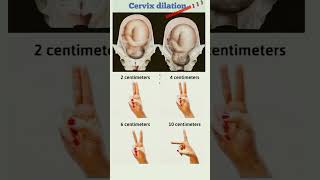 🤰🤰 Dilation of cervix 🤰🤰👩‍⚕️👩‍⚕️ [upl. by Ohare]