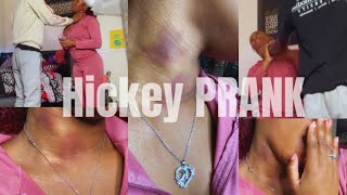 Hickey Prank On My Protective boyfriend got heated [upl. by Ilka]