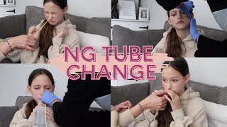 HAVING MY NG TUBE CHANGED  Tillies Journey [upl. by Ameer]