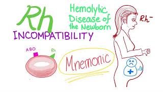 Rh incompatibility mnemonic [upl. by Bysshe]