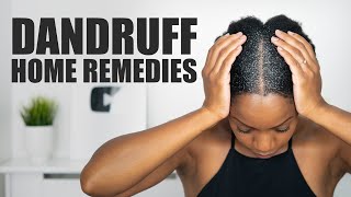 8 HOME REMEDIES to FIGHT DANDRUFF [upl. by Aihsad838]