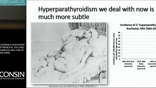 9718 Hyperparathyroidism Beyond Stones and Bones [upl. by Redvers173]