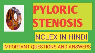 PYLORIC STENOSISIMPORTANT QUESTIONS AND ANSWERSNCLEX IN HINDI [upl. by Refenej]