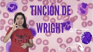 Tincion de wright [upl. by Humfried]