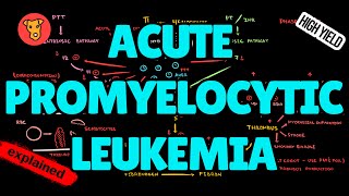 ACUTE PROMYELOCYTIC LEUKEMIA Pathogenesis DIC Changes in Blood analysis ATRA Treatment [upl. by Ellierim142]