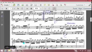 Beethoven Für Elise music analysis  music appreciation [upl. by Thompson]