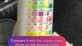 Urine Investigation Dipstick Method [upl. by Guimond]