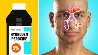 11 Benefits of Hydrogen Peroxide Most People Don’t Know [upl. by Emsoc582]