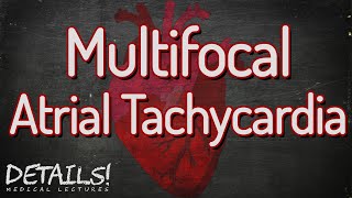 Multifocal Atrial Tachycardia MAT  Details [upl. by Lehacim]