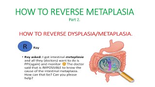 Metaplasia dysplasia How to reverse dysplasia metaplasia Causes of metaplasia [upl. by Isiahi357]