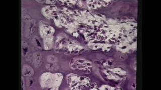 Practical Exam segment from Bone DVD 6 in the Visual Histology DVD Series wwwvisualhistologycom [upl. by Xaviera]