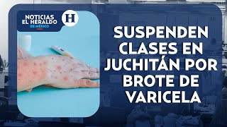 Primaria de Oaxaca es puesta en cuarentena por brote de varicela  Noticias el Heraldo [upl. by Valli780]