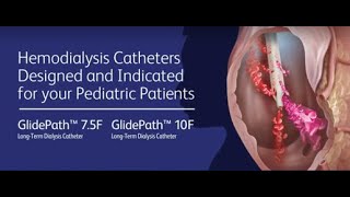 BD GlidePath™ 75F and 10F LongTerm Hemodialysis Catheter for pediatric use [upl. by Aekal524]