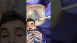 Hematoma subungueal curiosidades sabiasque [upl. by Eileek960]