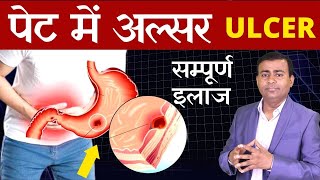 पेट में अल्सर सम्पूर्ण इलाज Peptic Ulcer Gastric Ulcer ulcers treatment Duodenal Hindi [upl. by Suivat]