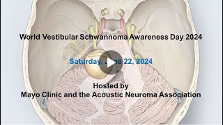 Technical pearls for facial nerve microdissection [upl. by Elhsa768]