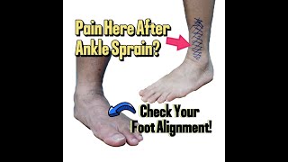 After Ankle Sprain and Surgery Check Your Foot Alignment [upl. by Notnad]