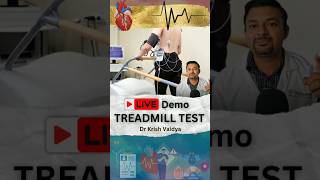 Live Treadmill Test heart treadmill hearthealth shorts short shortvideos drkrishvaidya [upl. by Hcire]