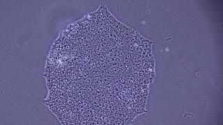 Assessing iPSC Morphology [upl. by Noorah]