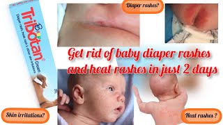 REVIEW ON BABY TRIBOTAN CREAMHOW TO GET RID OF DIAPER RASH amp HEAT RASH viralvideos youtube vlog [upl. by Brace]