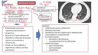 4 BRONQUIECTASIAS [upl. by Gerc]