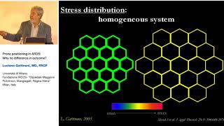 Prone position in ARDS L Gattinoni 2005 Strasburg 23 [upl. by Aicilaana]