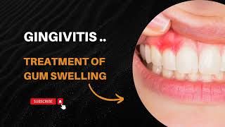 Gingivitis Complete Treatment  Swelling in Gums ⚕️⚕️ [upl. by Lledyr]