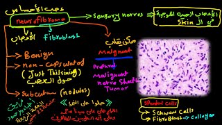 2 Pathology of CNS  tumors of CNS part 2  للدكتور عبدالرحمن خليفة  لأمراض الجهاز العصبي المركزي [upl. by Leahcimnoj]