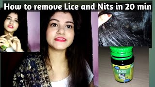 Hair lice and Nits Killer hair lice removal how to remove lice and Nits Lycil Oil lice removal [upl. by Gram]