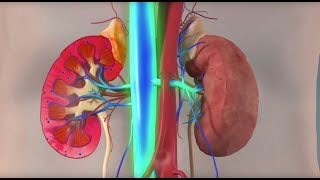 Rhabdomyolysis  Mayo Clinic [upl. by Dag]