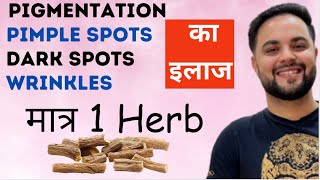 मात्र 1 Herb से Pigmentation Pimple Spots Dark Spots amp Wrinkles का इलाज [upl. by Faro]