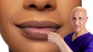 How to Plump Your Lips Naturally Dr Mandell [upl. by Enohs]