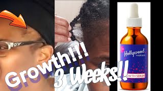 HOLLYWOOD HAIR BAR GROW MY EDGES3 WEEKS Results It Really Worked [upl. by Baggett]