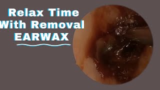 P15Safe Methods for Ear Wax RemovalHELLO HEALTH asmr [upl. by Aillemac]