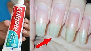 1 रात मे नाखुनो को लम्बे मज़बूत और सुन्दर करने का रामबाण उपाए  Grow strong Nails fast at home [upl. by Sibyl]