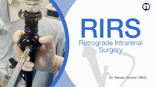 RIRS  Retrograde Intrarenal Surgery  Latest scarless Laser Kidney Stone Surgery [upl. by Matthews573]