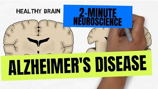 2Minute Neuroscience Alzheimers Disease [upl. by Adnic]