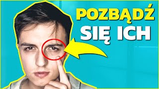 CIENIE  WORKI POD OCZAMI u mężczyzn  jak się ich pozbyć 3 domowe sposoby  DAVID DURDEN [upl. by Lucio]