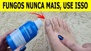 NUNCA MAIS TIVE FUNGOS E MICOSE NAS UNHAS DEPOIS QUE VI ESSA RECEITA [upl. by Madeleine]