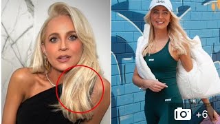 Carrie Bickmores Hilarious Hair Extension Fail [upl. by Inaluiak]