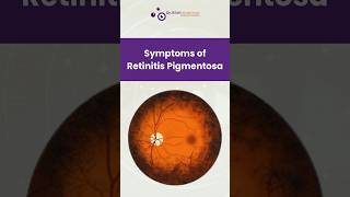 Symptoms of Retinitis Pigmentosa [upl. by Trawets]