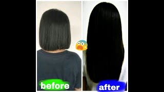 How to grow your hair quickly 20 cm in one week [upl. by Atlante70]