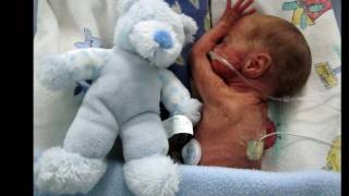 24 Week Preemie  Christiaan Brink Jou eerste jaar  Your first year [upl. by Enilaf96]